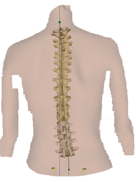 Lösung bei Schmerzen im unteren Rücken